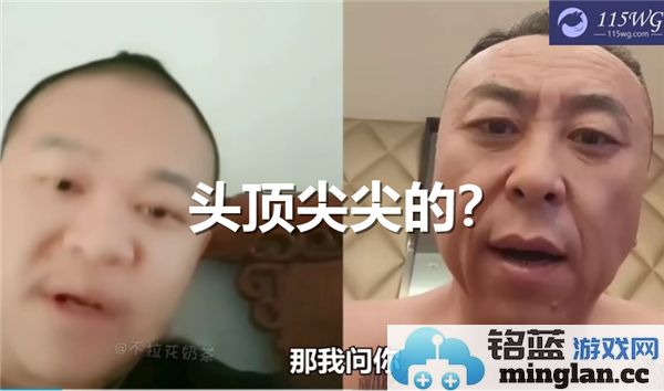 为何常熟阿诺之头顶犹如飞机般尖尖，令人叹为观止？